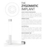 Zygomatic Implant