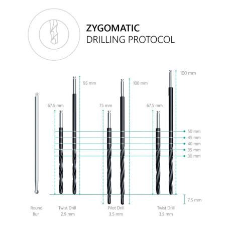 Zygomatic Implant