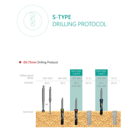 S-Type Implant