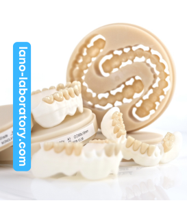 YUCERA Multilayer PMMA Blocks. Ultra-Realistic Temporaries
